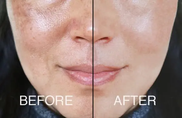 Adrien Arpel The Complete Fix Youth Serum - Image 3